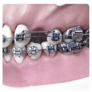 RESORTE MEMORIA CERRADA LC1230-01